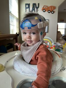 baby helmet blue bell pa Cranial Remolding